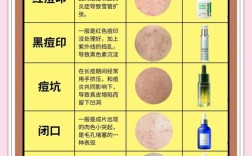 祛痘印哪种方法最有效？