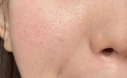 天然祛痘美白缩小毛孔，真能同时实现吗？