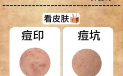 祛痘祛印用什么好？