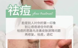 保定祛痘祛痘印一般要花多少钱？