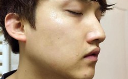 呼吸魔法精华能祛痘印吗？