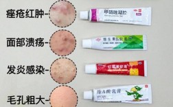 痘痘肌选护肤品，避开哪些成分更有效？