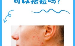 男士祛痘印什么方法最有效？