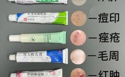 如何快速有效祛痘？