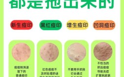 学生祛痘去痘印有哪些小妙招？