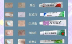 祛痘印选药膏还是护肤品？