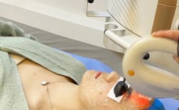 激光祛痘印和光子嫩肤哪个更适合你？