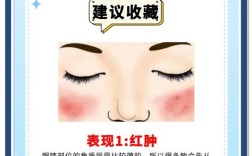 脸过敏必须停用护肤品吗？