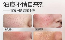 祛痘印面膜什么牌子最有效？