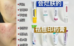 祛痘印什么药效果最好？