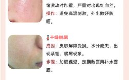 脸过敏可以涂护肤品吗