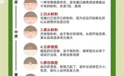 脸上痘痘怎么快速祛痘？