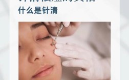 祛痘能彻底根治吗？