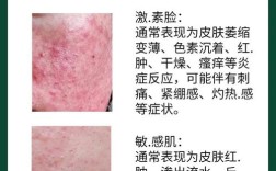 护肤品含激素会有什么危害？