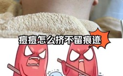 专业挤痘痘祛痘靠谱吗？