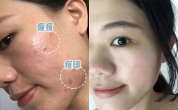 瓷妆祛痘产品效果真的好吗？