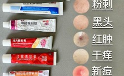 哪家产品祛痘印效果好