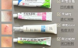 wis祛痘印凝胶正确用法是什么？