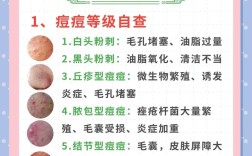 如何快速祛痘不留痘印？