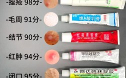 激素祛痘药膏用完会有哪些反应？