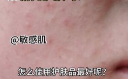 护肤品过敏多久能好？