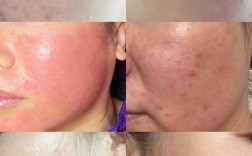 过度护肤，皮肤会伤不起吗？