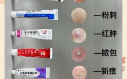 小紫瓶祛痘膏效果到底好不好？