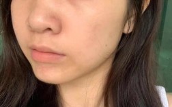 祛痘产品反而致痘，是哪里出问题了？