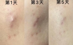 奥蜜思祛痘效果真的好吗？