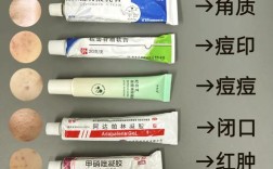 摸什么药能快速祛痘？