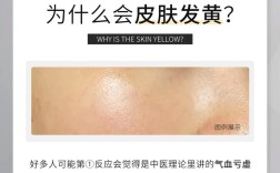 护肤品用后脸发黄是为何？
