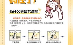 祛痘祛痘印最有效方法是什么？