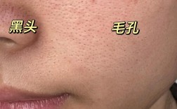 黑头毛孔粗大，护肤品怎么选才有效？