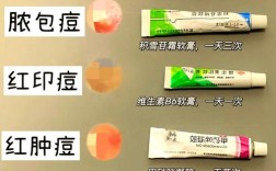 祛痘产品怎么选才有效？