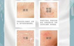 皮肤不吸收护肤品，问题出在哪？