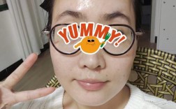 激光祛痘后该用什么水洗脸？