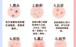 ddq祛痘效果究竟如何？