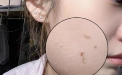 脸上有死皮，护肤怎么选？