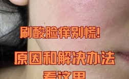 护肤品用后脸刺痛是为什么？