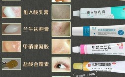 祛痘印缩小毛孔用什么