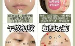 内干外油的皮肤护肤品