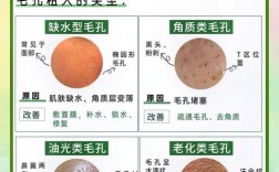 祛痘粉刺毛孔粗大，怎么一起解决？