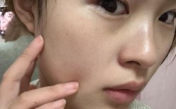 护肤品擦脸辣辣的是怎么回事？