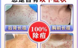 北京同仁堂祛痘喷雾剂效果如何？