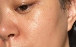 护肤品涂完脸为什么油油的？