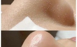 去黑头缩毛孔，护肤品真能同时搞定吗？