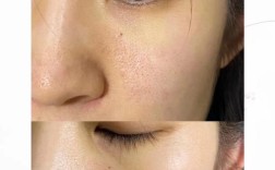 祛痘印收缩毛孔，选哪个产品更好？