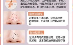 祛痘泥膜天天用会伤肤吗？