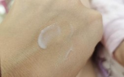 标婷维生素E乳能祛痘印吗？