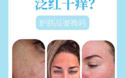 过敏后多久能安全用护肤品？